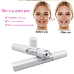 Acne Laser Pen | Blue Light Therapy Acne Laser Pen | EasyMon