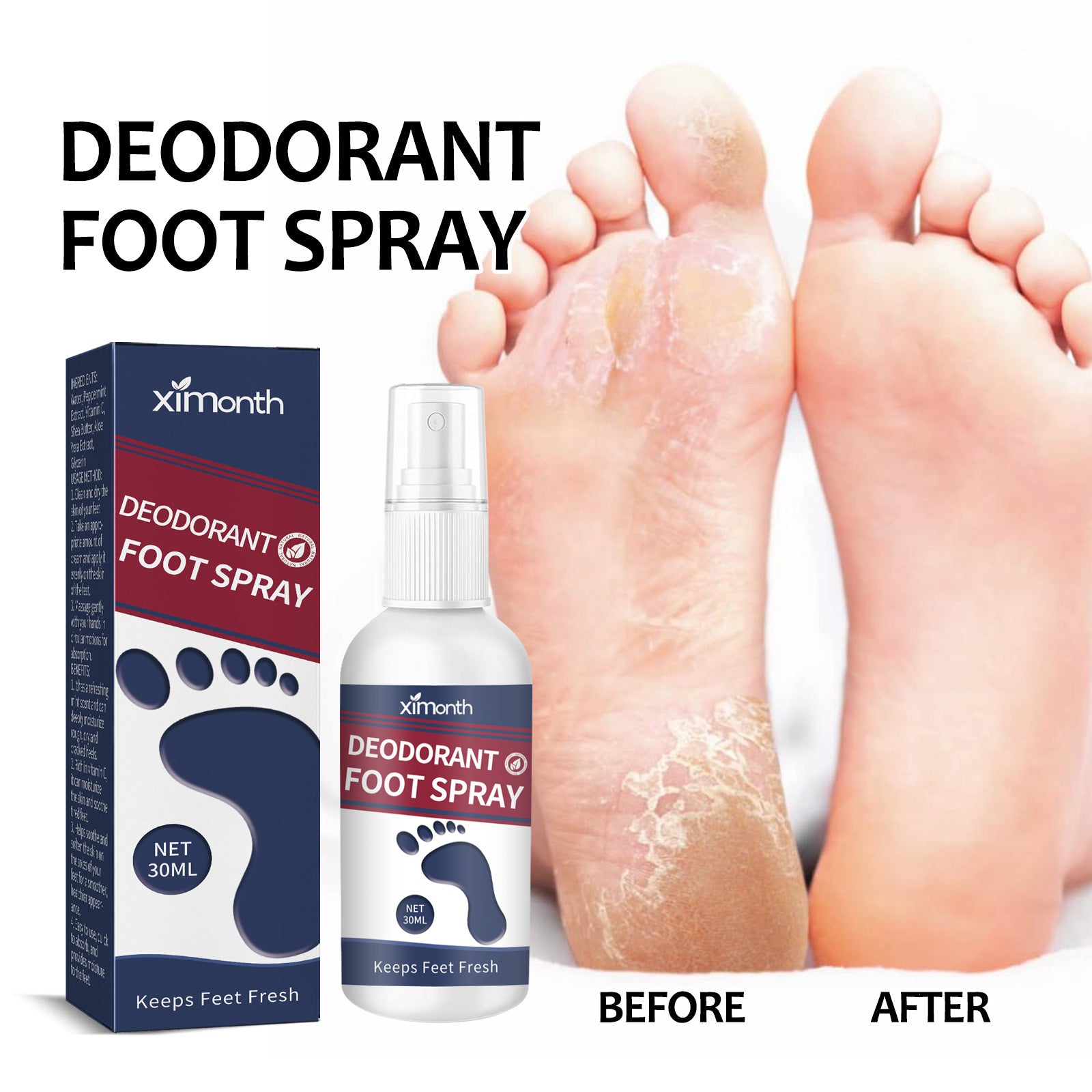Replenishment Foot Spray | Replenishment Care Spray | EasyMon